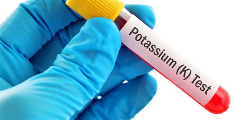 Potasyum kan değeri